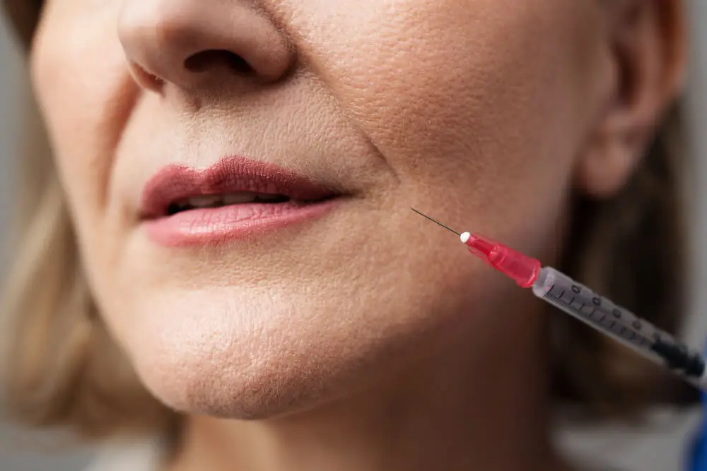 dermal fillers vs botox