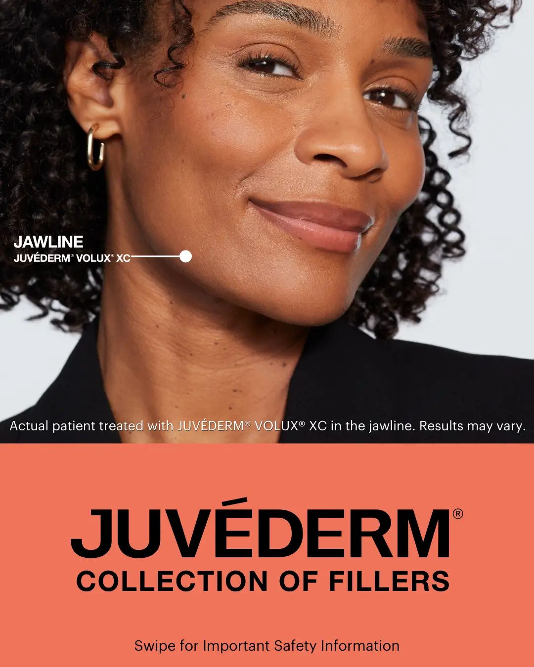Kristin model demonstrating facial contour after Volux filler for the chin and jawline.