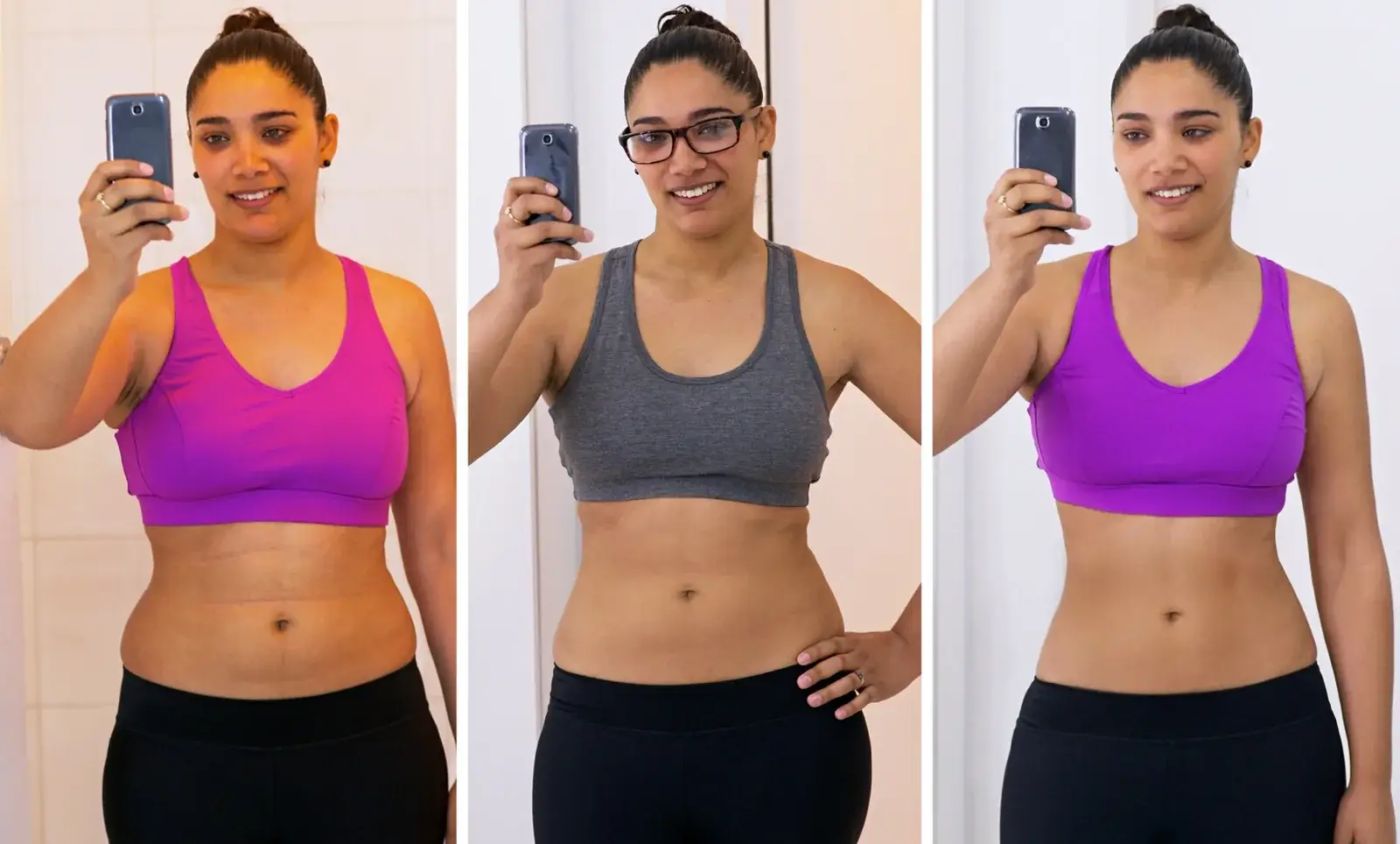 Progress photos showing visible reduction in waistline over time for a female patient.