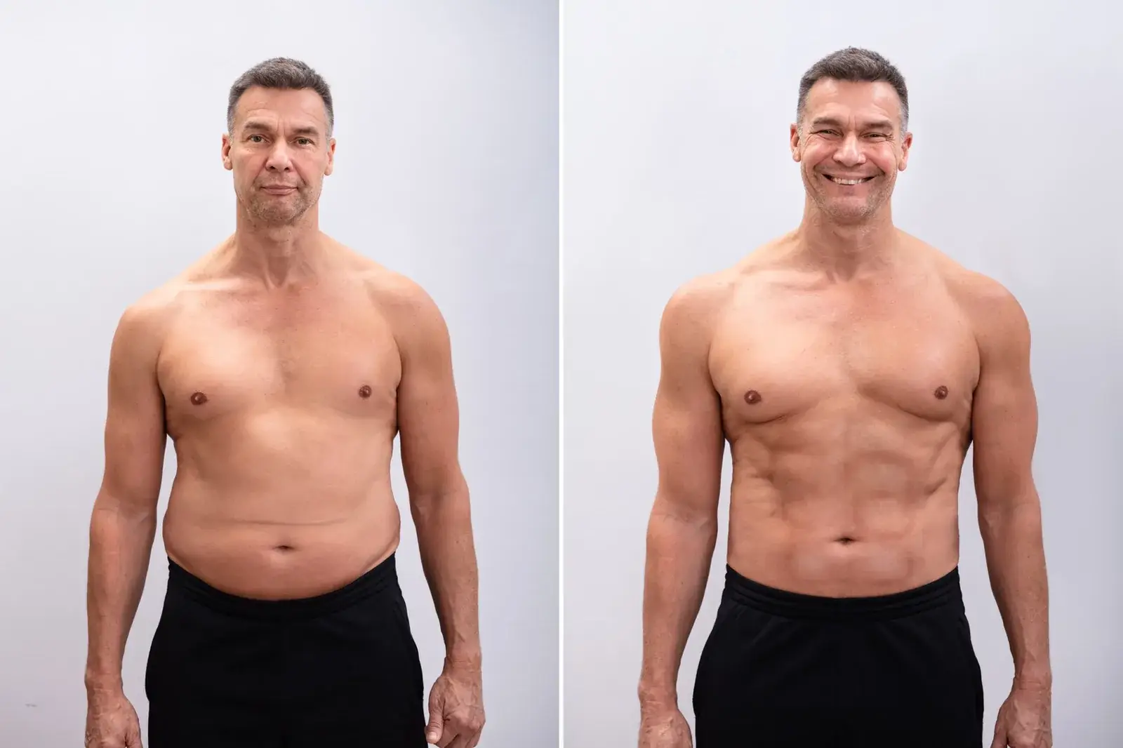 Front-facing before and after images showing reduced abdominal girth for a male patient.