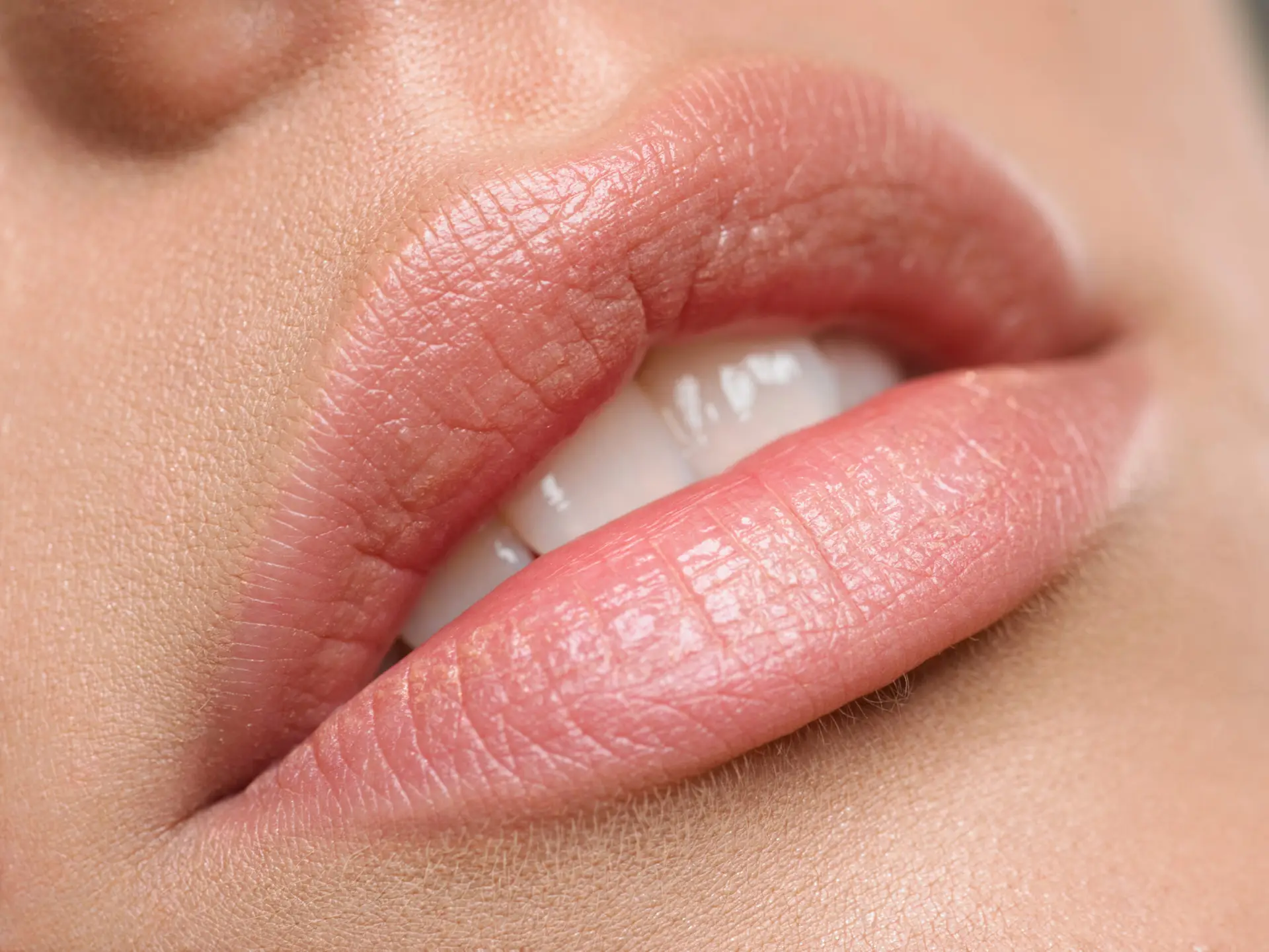 Perioral detail — border clarity and hydration