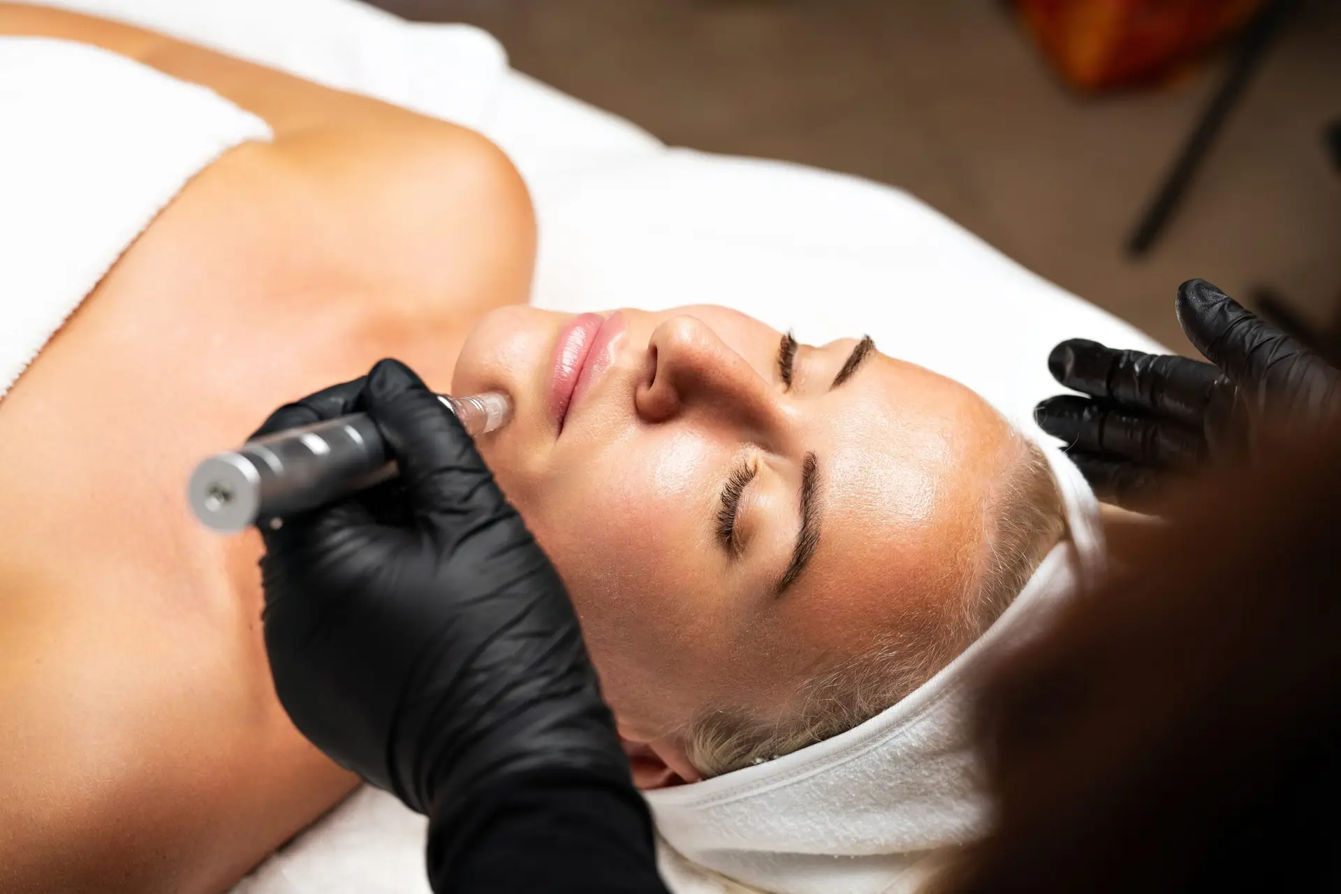 A patient receiving a professional microneedling treatment at The Maxim Clinic in Atlanta.